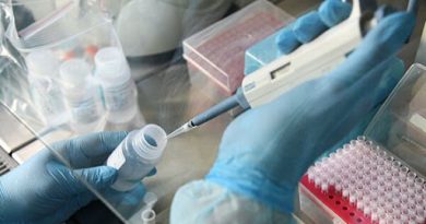 В Молдове выявлено 82 новых случая заражения коронавирусом