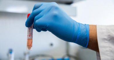 В Гагаузии за сутки 12 новых случаев коронавируса